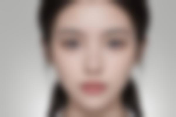 李宜欣医生技术优势有哪些？