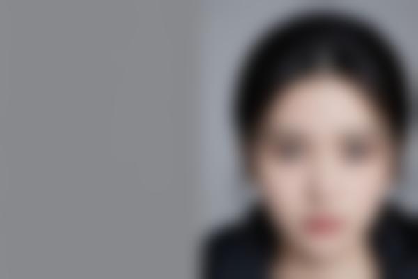 郑州陈涛全鼻美塑拉皮修复好，陈涛医生脂肪填充存活率90%+自然持久！