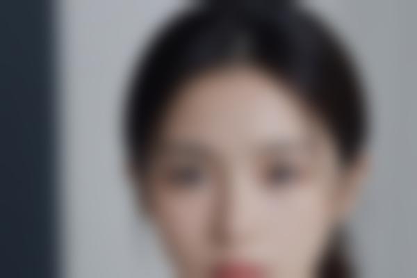郑州于艳菊医生疤痕胎记修复，40年临床经验打造自然美肌！