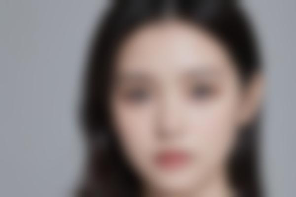 石家庄陈慧玲医生胎记疤痕修复技术,30年经验让皮肤问题无疤!
