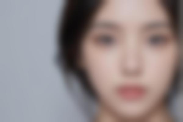 向艺医生做鼻整形价格多少钱？