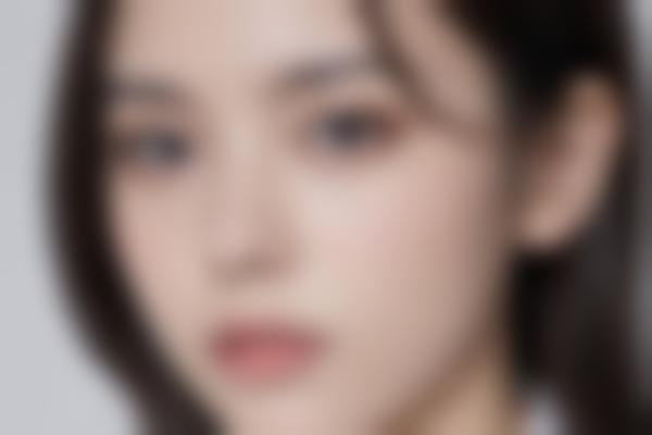 疤痕修复的真实蜕变
