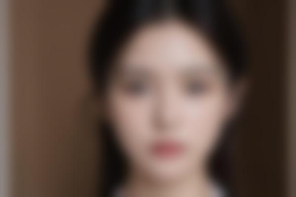 许淑菊修复价格多少钱？