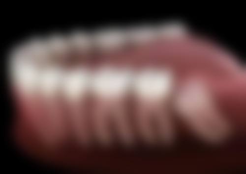 深圳格伦菲尔口腔医院收费标准：种植牙/牙齿矫正/补牙/根管治疗等