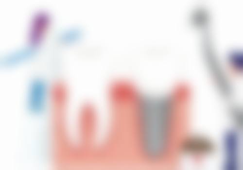 技术设计：TSSA亲水技术有何特别？