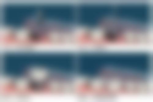 深圳格伦菲尔口腔医院半口种植牙价格25000+｜轻松上牙岗，稳固省心还不贵