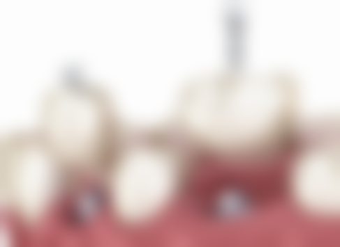 三、德州平原县创优口腔诊所核心科室与特色项目