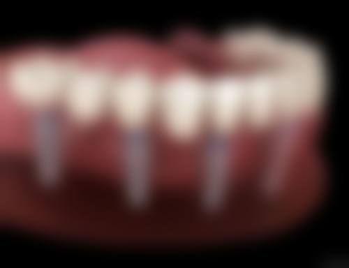 三、济南市中贝健口腔核心科室与特色项目