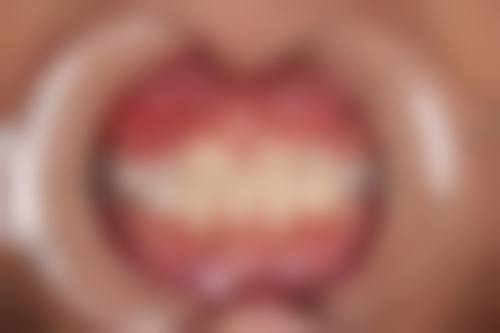 七、江苏苏州昆山虹桥医院口腔就医指南，便捷就诊不迷路