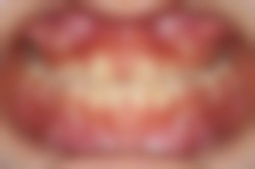 五、陕西安康石泉雅美口腔诊所舒适就医环境,打造人性化诊疗体验