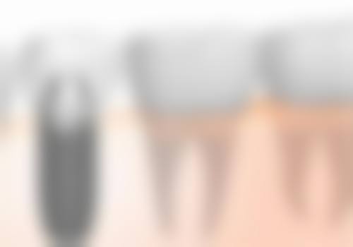 四、云浮嘉云口腔门诊部设备介绍