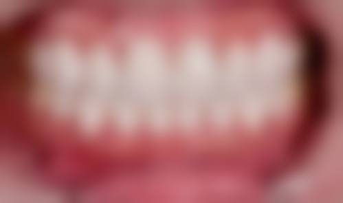 四、内蒙古呼和浩特宋娟口腔诊所设备介绍