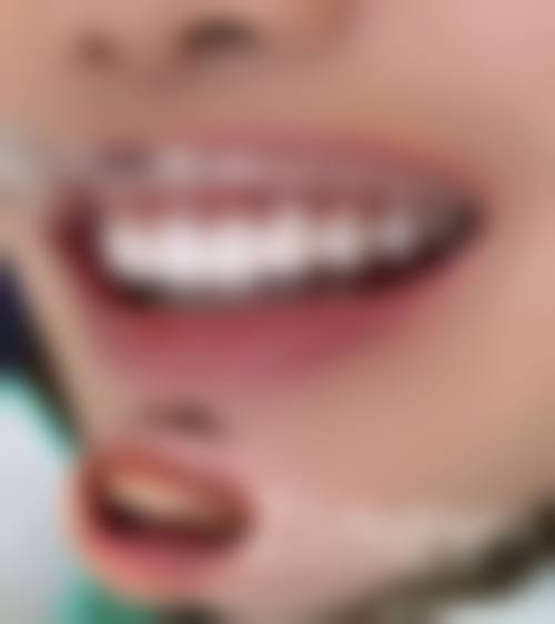 五、淮安艺植植发舒适就医环境，打造人性化诊疗体验