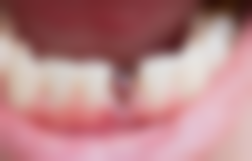 五、深圳鼎植口腔(罗湖口岸旗舰店)舒适就医环境，打造人性化诊疗体验