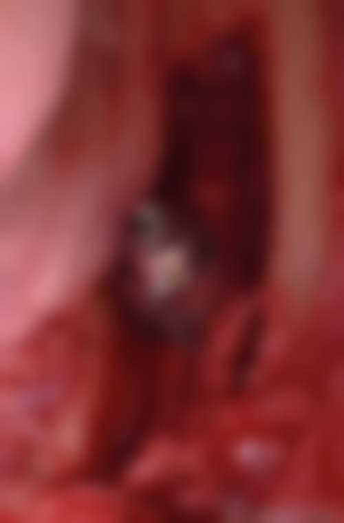 七、深圳鼎植口腔(罗湖口岸旗舰店)就医指南，便捷就诊不迷路