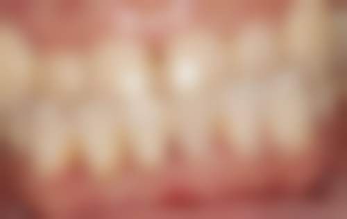 七、江津益尔口腔就医指南，便捷就诊不迷路