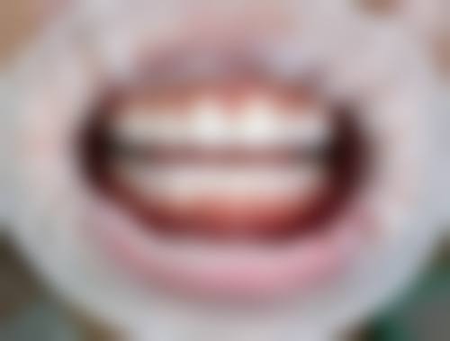 三、广东深圳瑞奥口腔诊所核心科室与特色项目