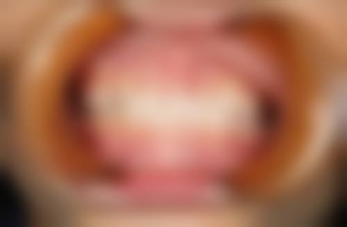 四、温州瑞安阮再波口腔设备介绍