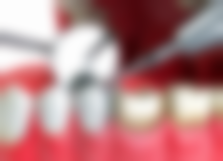 三、禹城华盛口腔核心科室与特色项目