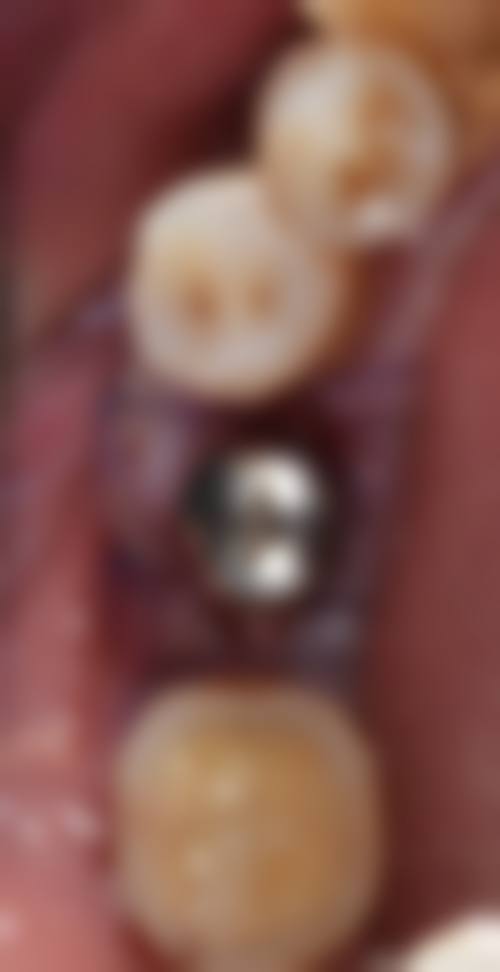 四、昆山牙康口腔门诊部设备介绍