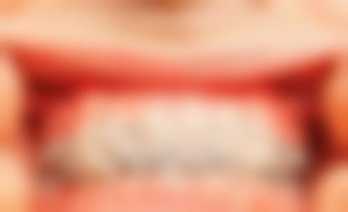 四、益齿达口腔门诊部设备介绍