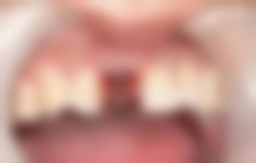 四、农群口腔诊所(斯麦儿口腔)设备介绍