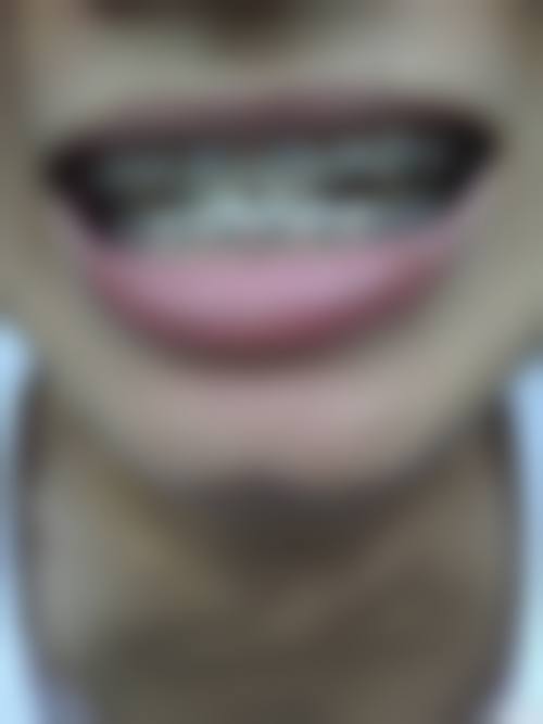 七、吉林白山市向阳口腔就医指南，便捷就诊不迷路