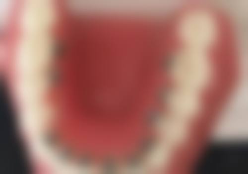 四、广东东莞域美口腔设备介绍