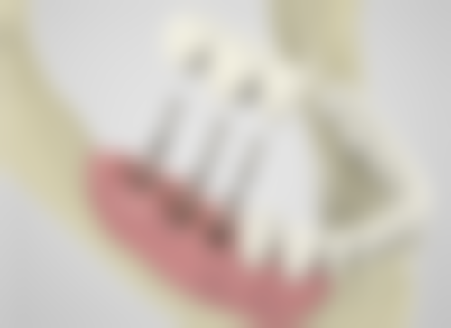 六、福建泉州鲤城林辉阳口腔荣誉资质与患者口碑,见证品牌实力