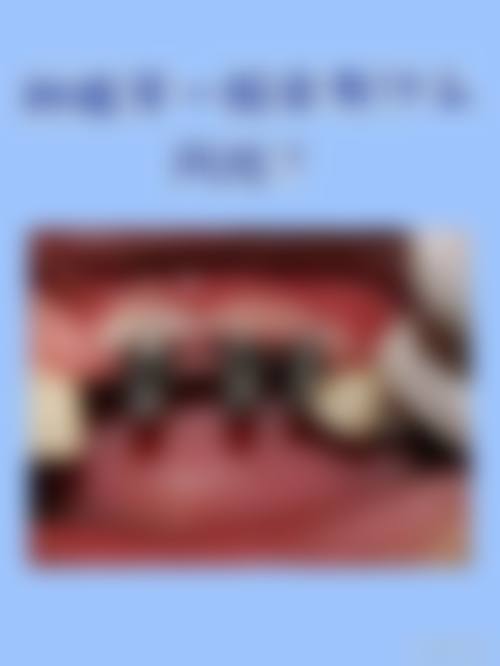 四、莱芜颐高口腔设备介绍