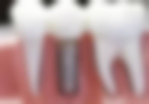 五、山东潍坊诸城微至口腔舒适就医环境，打造人性化诊疗体验