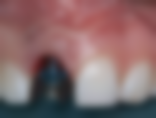 四、威海石磊口腔设备介绍