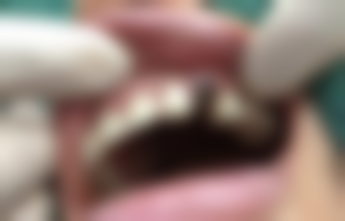 七、浙江杭州正植口腔就医指南,便捷就诊不迷路