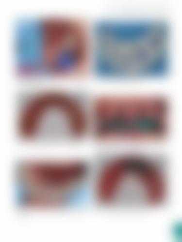 四、石家庄长安康博口腔诊所设备介绍