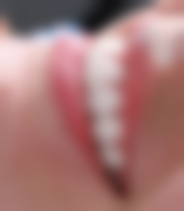 二、河北石家庄正定瑞朗口腔医生团队，打造专精诊疗服务