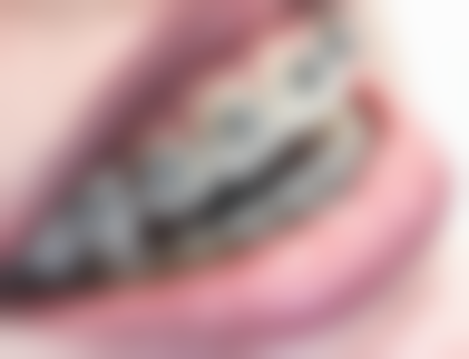 四、岳阳经济技术开发区博瑞口腔门诊部设备介绍