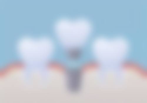 四、娄宇翔口腔诊所设备介绍