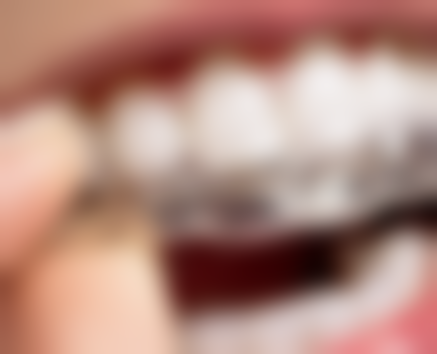 五、潍坊高新雅客石口腔舒适就医环境,打造人性化诊疗体验