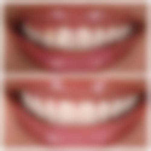 六、广州瑞德口腔白云旗舰院荣誉资质与患者口碑,见证品牌实力