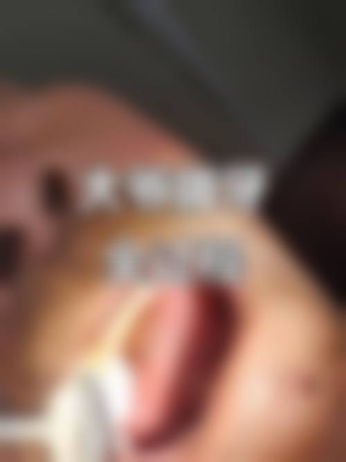 七、苏州益峰口腔·种植矫正儿童齿科就医指南，便捷就诊不迷路