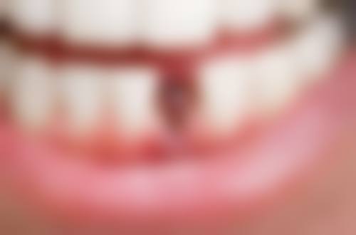 六、四川成都高新一丫齿科荣誉资质与患者口碑，见证品牌实力