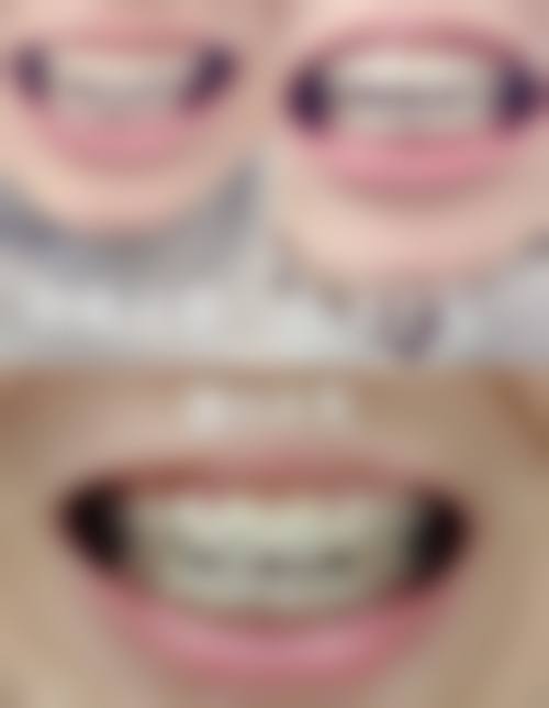 四、普洱思茅王春口腔诊所设备介绍