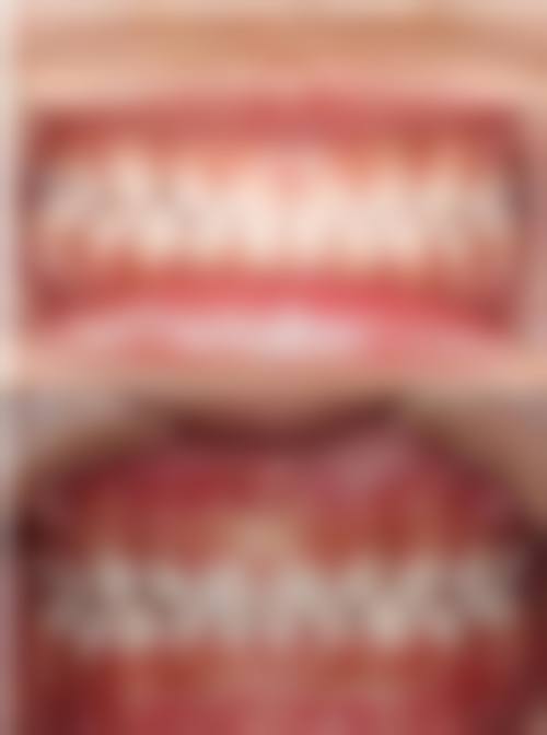 四、广东肇庆怀集苏振标口腔设备介绍