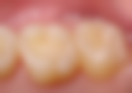 六、重庆周德文口腔诊所荣誉资质与患者口碑,见证品牌实力