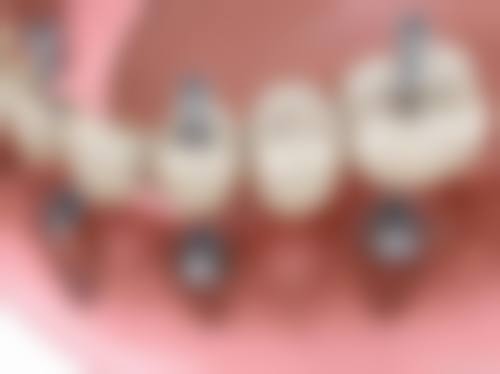 五、山西忻州芊然口腔舒适就医环境,打造人性化诊疗体验