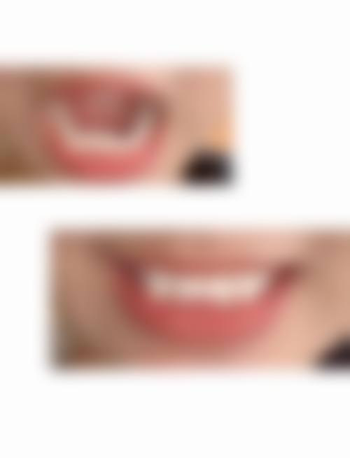 二、陕西西安程玲口腔医生团队,打造专精诊疗服务