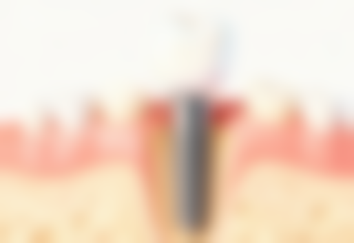 四、邢台襄都齐尔美口腔设备介绍