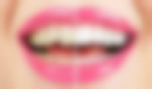 四、壹号（珠海）口腔诊所设备介绍