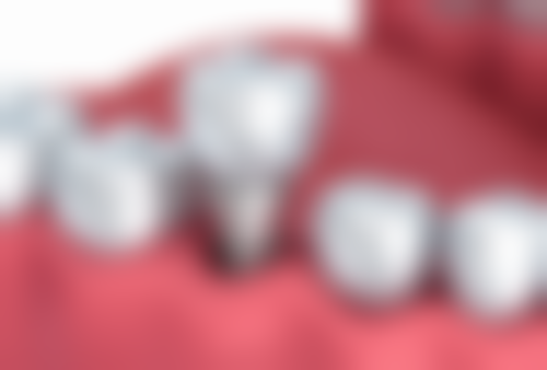 三、佛山利永均口腔门诊部核心科室与特色项目