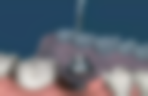 二、河北医 科 大学第二医院口腔修复科医生团队,打造专精诊疗服务